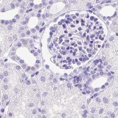 Immunohistochemistry-Paraffin: PDIA2 Antibody [NBP2-49015]