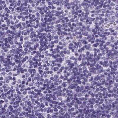 Immunohistochemistry-Paraffin: PDIA2 Antibody [NBP2-49015]