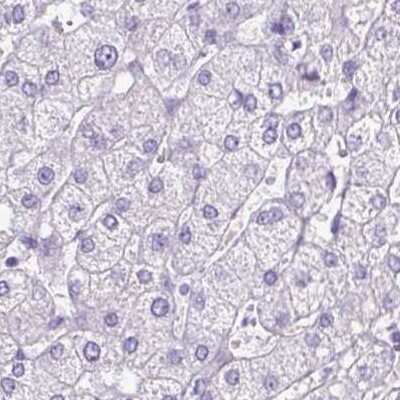 Immunohistochemistry-Paraffin: PDIA2 Antibody [NBP2-49015]