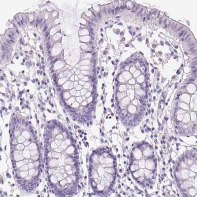 Immunohistochemistry-Paraffin: PDIA2 Antibody [NBP2-49086]