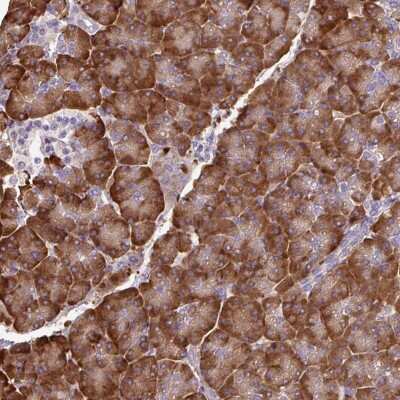 Immunohistochemistry-Paraffin: PDIA2 Antibody [NBP2-49086]