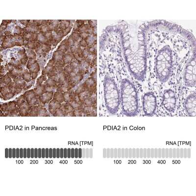 Immunohistochemistry-Paraffin: PDIA2 Antibody [NBP2-49086]