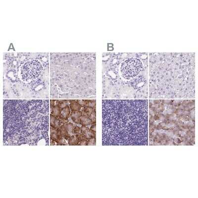Immunohistochemistry-Paraffin: PDIA2 Antibody [NBP2-49086]