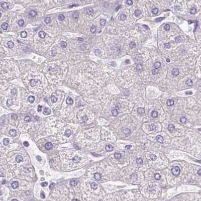 Immunohistochemistry-Paraffin: PDIA2 Antibody [NBP2-49086]