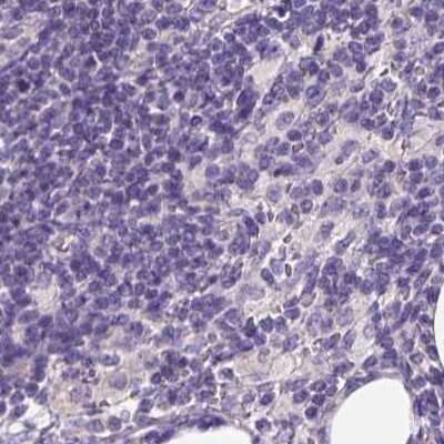 Immunohistochemistry-Paraffin: PDIA2 Antibody [NBP2-49086]