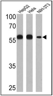 Western Blot: Protein Disulfide Isomerase/P4HB Antibody (RL77) [NB600-1164]