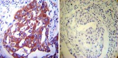 Immunohistochemistry-Paraffin: Protein Disulfide Isomerase/P4HB Antibody (RL90) [NB300-517]