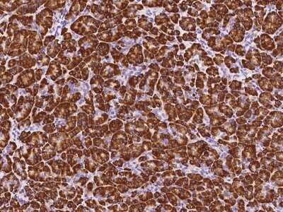 Immunohistochemistry-Paraffin: PDIA2 Antibody [NBP2-99080]