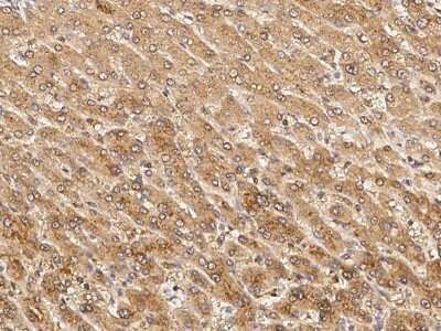 Immunohistochemistry-Paraffin: PDIA2 Antibody [NBP2-99080]