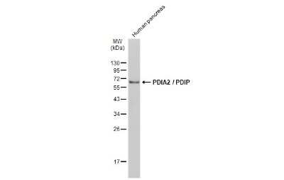 Western Blot: PDIA2 Antibody [NBP3-13149]