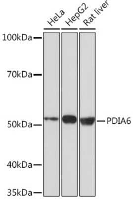 Western Blot: PDIA6 Antibody (2Q1L1) [NBP3-16365]