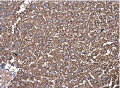 Immunohistochemistry-Paraffin: PDIA6 Antibody [NBP2-19750]