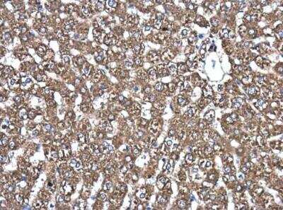 Immunohistochemistry-Paraffin: PDIA6 Antibody [NBP2-19750]