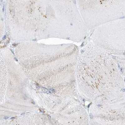 Immunohistochemistry-Paraffin: PDIA6 Antibody [NBP2-38213]