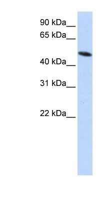 Western Blot: PDIA6 Antibody [NBP1-57968]