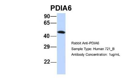 Western Blot: PDIA6 Antibody [NBP1-57968]