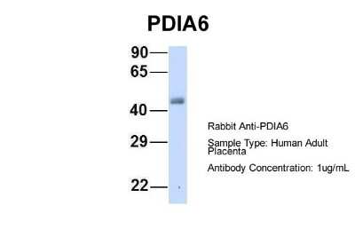 Western Blot: PDIA6 Antibody [NBP1-57968]