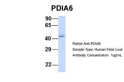 Western Blot: PDIA6 Antibody [NBP1-57968]