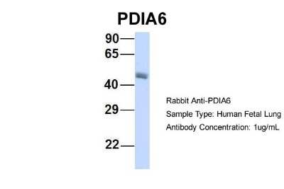 Western Blot: PDIA6 Antibody [NBP1-57968]