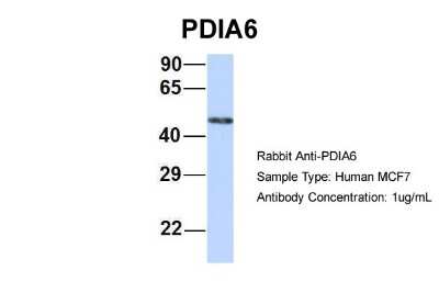 Western Blot: PDIA6 Antibody [NBP1-57968]
