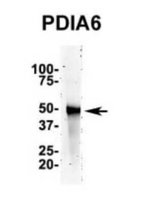 Western Blot: PDIA6 Antibody [NBP1-57999]