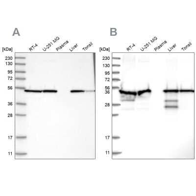 Western Blot: PDIA6 Antibody [NBP1-84798]