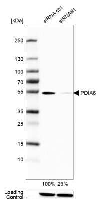 Western Blot: PDIA6 Antibody [NBP2-38213]