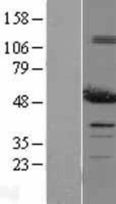 Western Blot: PDIA6 Overexpression Lysate [NBL1-14246]