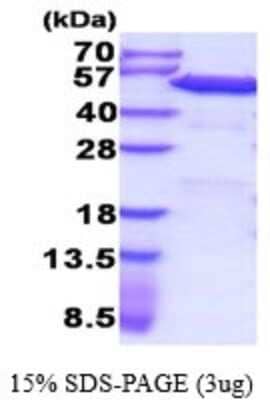 SDS-PAGE: Recombinant Human PDIA6 His Protein [NBP2-52142]