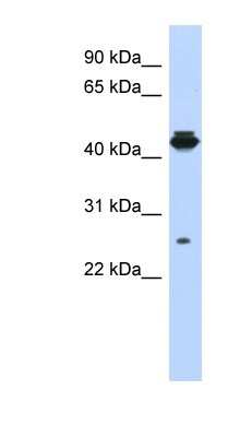 Western Blot: PDIK1L Antibody [NBP1-56732]