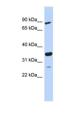 Western Blot: PDIK1L Antibody [NBP1-56733]