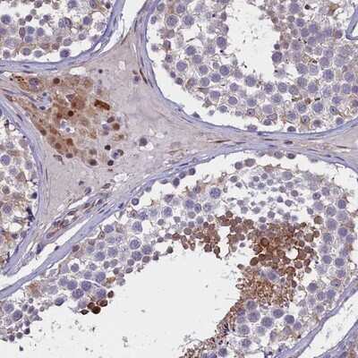 Immunohistochemistry-Paraffin: PDILT Antibody [NBP1-80933]