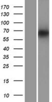 Western Blot: PDILT Overexpression Lysate [NBP2-05101]