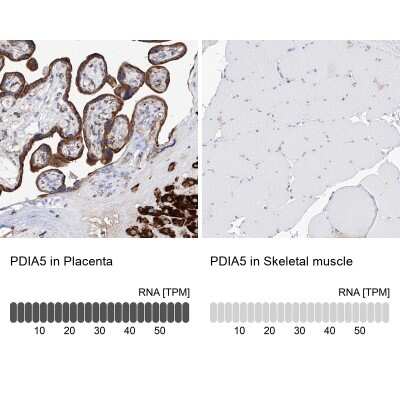 Immunohistochemistry-Paraffin: PDIR Antibody [NBP1-92250]