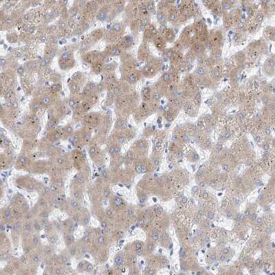 Immunohistochemistry-Paraffin: PDIR Antibody [NBP1-92250]