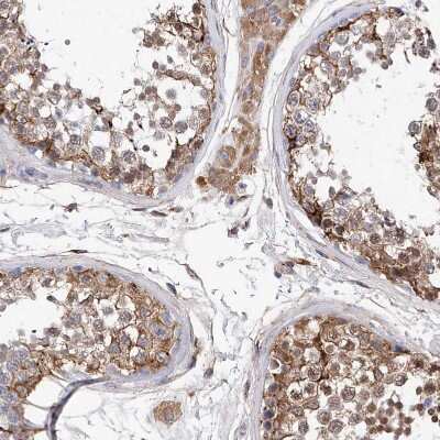 Immunohistochemistry-Paraffin: PDIR Antibody [NBP1-92250]