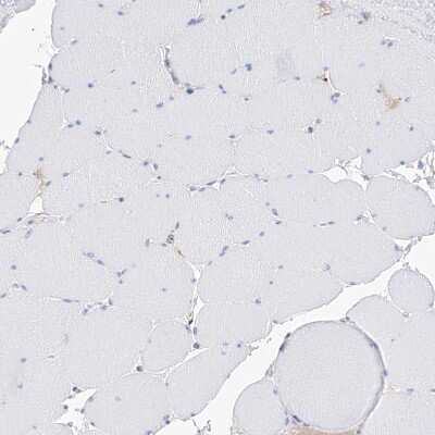 Immunohistochemistry-Paraffin: PDIR Antibody [NBP1-92250]