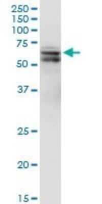 Western Blot: PDK-1 Antibody (2E2) [H00005170-M05]