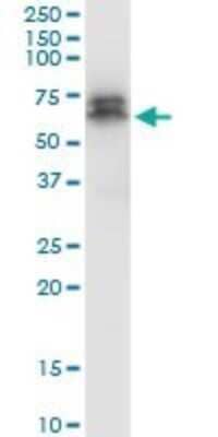 Western Blot: PDK-1 Antibody (2E2) [H00005170-M05]