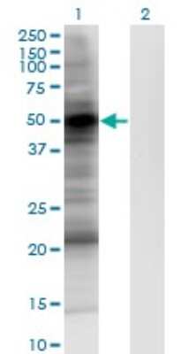 Western Blot: PDK-1 Antibody (2E2) [H00005170-M05]