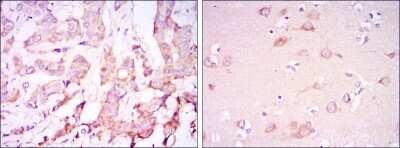Immunohistochemistry-Paraffin: Pyruvate Dehydrogenase Kinase 1/PDK1 Antibody (4A11) - BSA Free [NBP2-22171]
