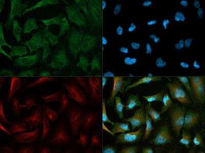 Immunocytochemistry/ Immunofluorescence: Pyruvate Dehydrogenase Kinase 1/PDK1 Antibody [NB100-2383]