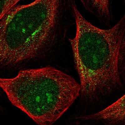 Immunocytochemistry/ Immunofluorescence: Pyruvate Dehydrogenase Kinase 1/PDK1 Antibody [NBP2-56835]