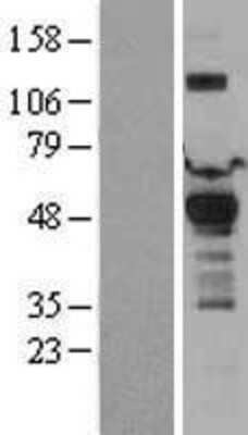 Western Blot: Pyruvate Dehydrogenase Kinase 1/PDK1 Overexpression Lysate [NBL1-14249]