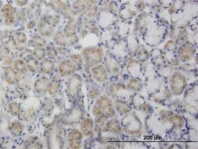 Immunohistochemistry-Paraffin: PDK2 Antibody (2G1) [H00005164-M01]