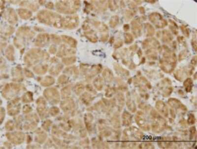Immunohistochemistry-Paraffin: PDK2 Antibody (5F8) [H00005164-M02]