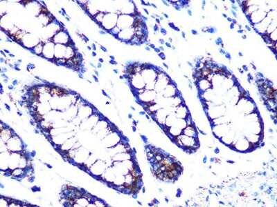 Immunohistochemistry-Paraffin: PDK2 Antibody (7X6R7) [NBP3-16314]