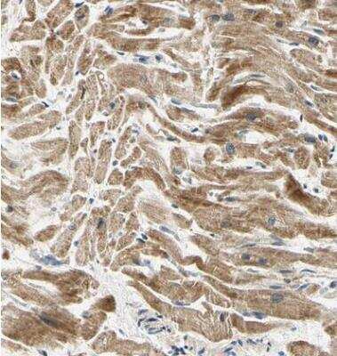 Immunohistochemistry-Paraffin: PDK2 Antibody [NBP1-87307]
