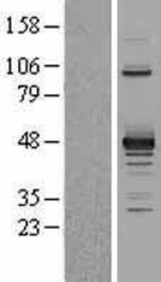 Western Blot: PDK2 Overexpression Lysate [NBL1-14250]