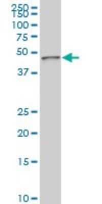 Western Blot: PDK3 Antibody (1G11) [H00005165-M03]